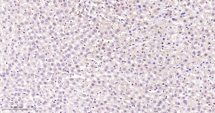 周期素依赖性激酶4重组兔单抗