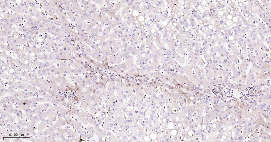 信号转导与转录激活因子1重组兔单抗