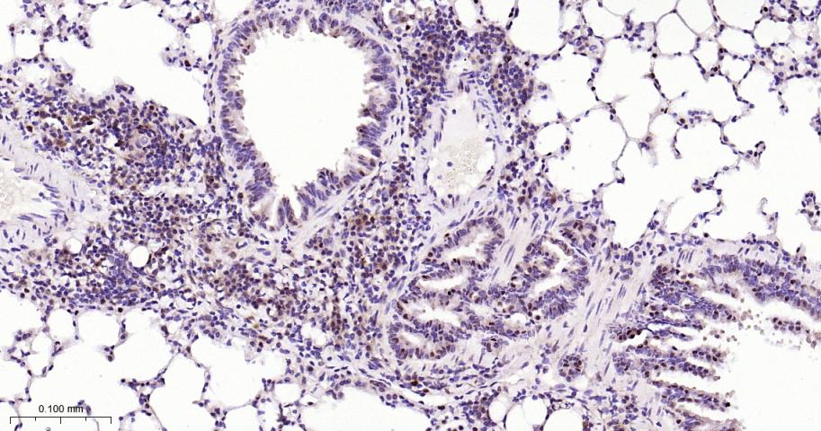 周期素依赖性激酶4重组兔单抗