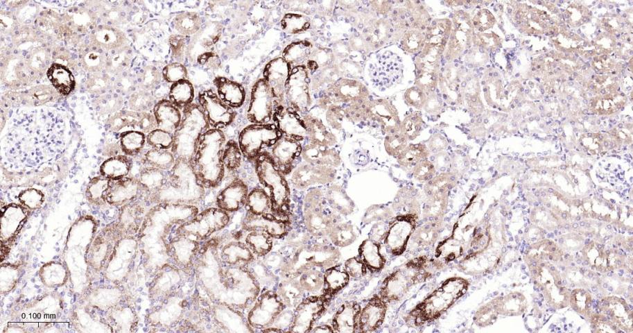 蛋白质酪氨酸激酶JAK-1重组兔单抗