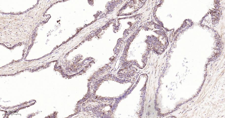 葡萄糖调节蛋白94重组兔单抗