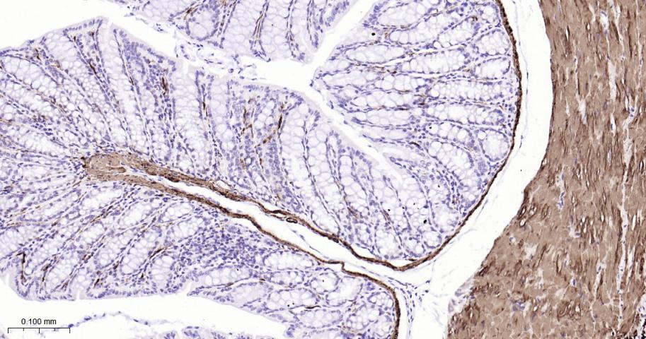 平滑肌肌球蛋白重链抗体