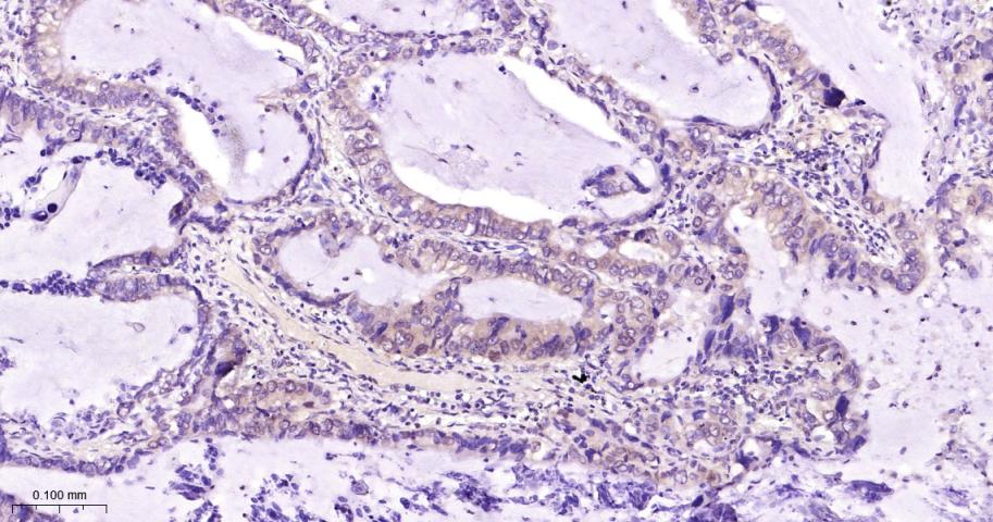 周期素依赖性激酶4重组兔单抗