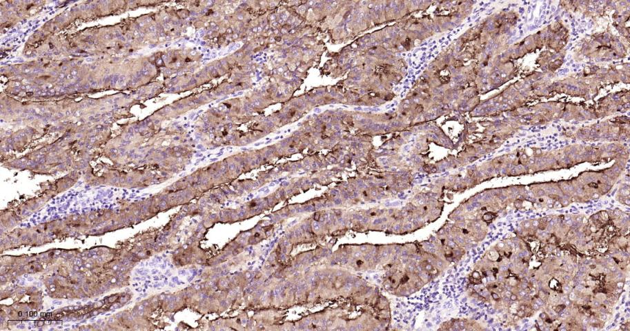 粘蛋白-1重组兔单抗