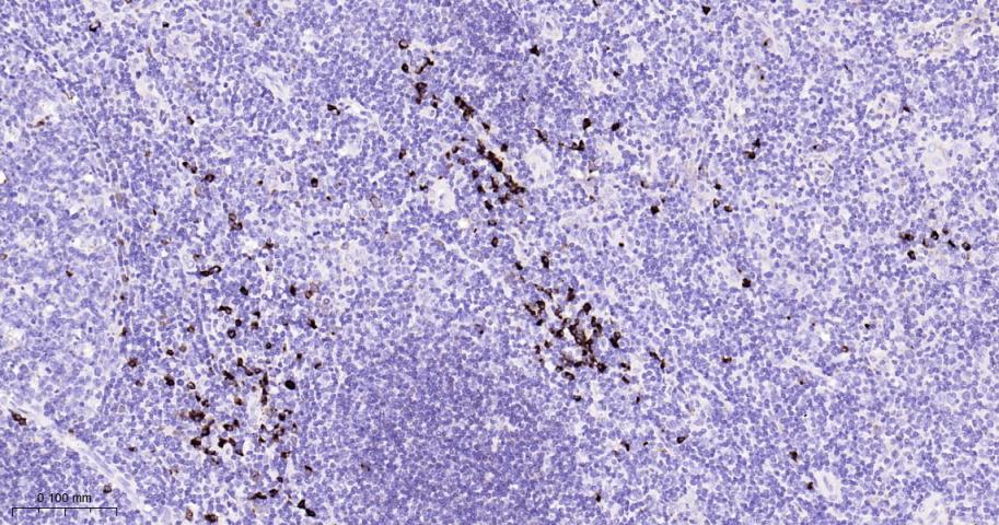 人k轻链重组兔单抗