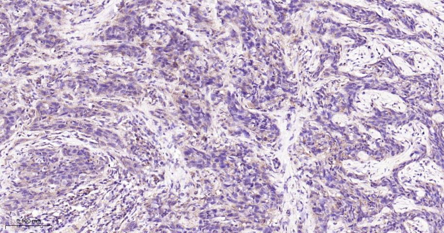 腺苷单磷酸活化蛋白激酶α1重组兔单抗