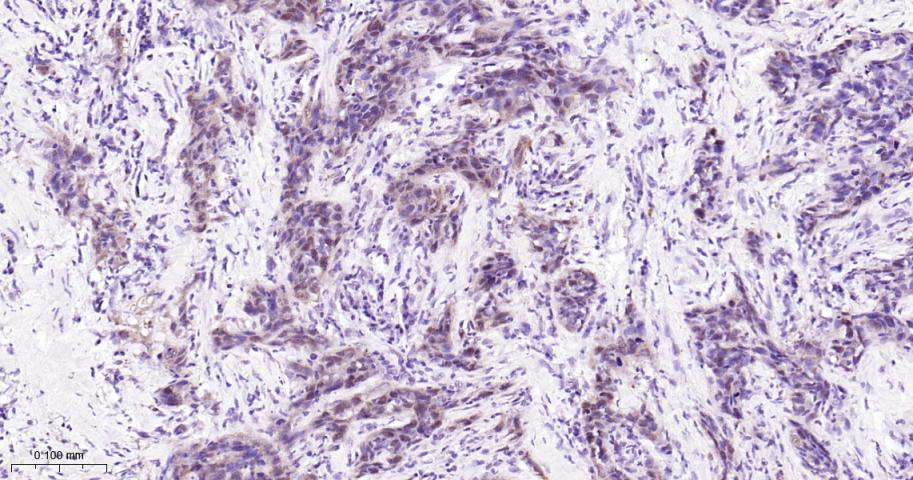 周期素依赖性激酶4重组兔单抗