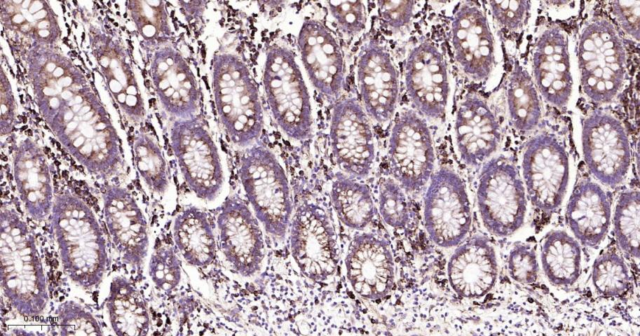 葡萄糖调节蛋白94重组兔单抗