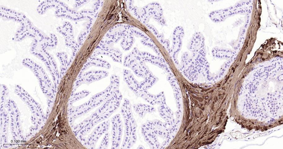 平滑肌肌球蛋白重链抗体