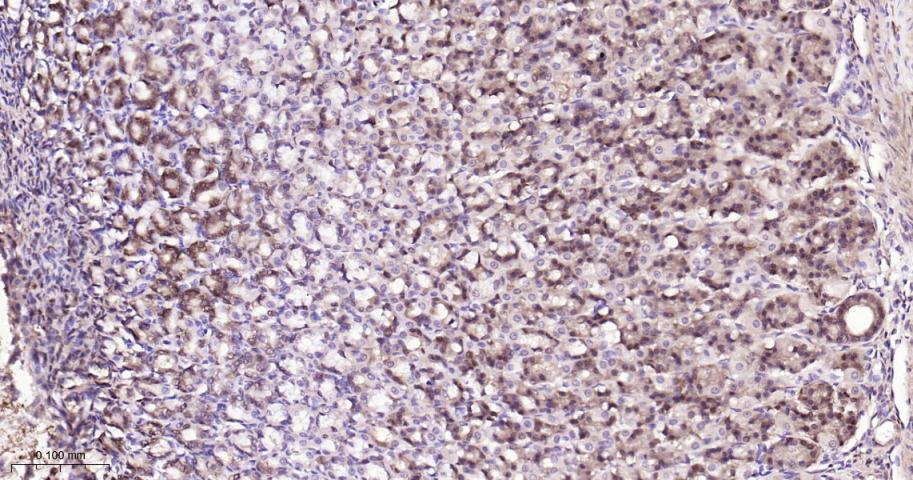 异柠檬酸脱氢酶1重组兔单抗