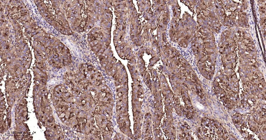 粘蛋白-1重组兔单抗