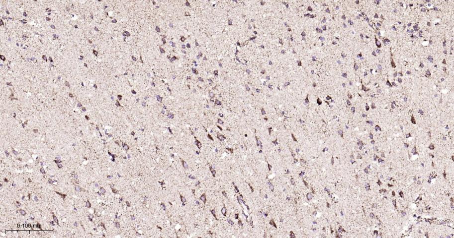 热休克蛋白10/HSPE1重组兔单抗