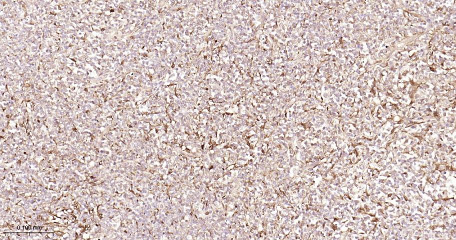 信号转导与转录激活因子1重组兔单抗