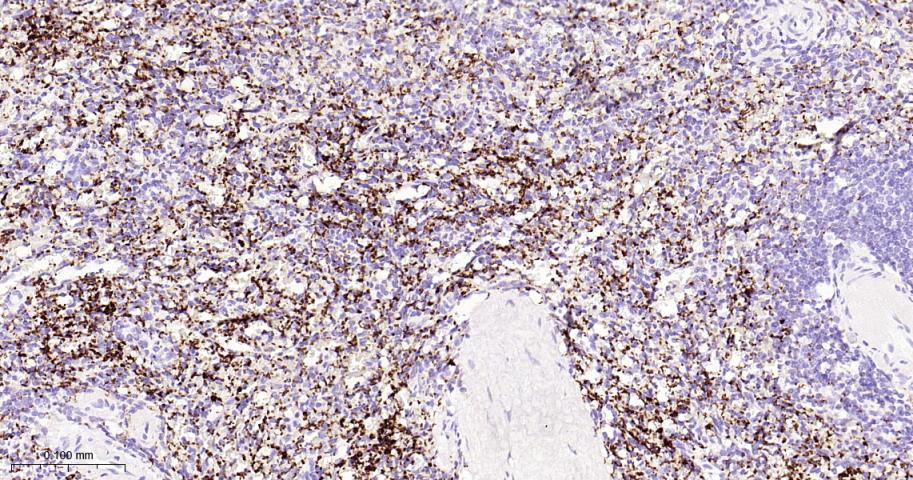 血小板糖蛋白GPIb（CD42b）重组兔单抗