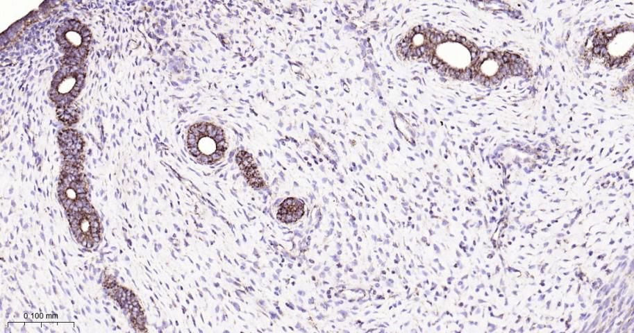 热休克蛋白10/HSPE1重组兔单抗