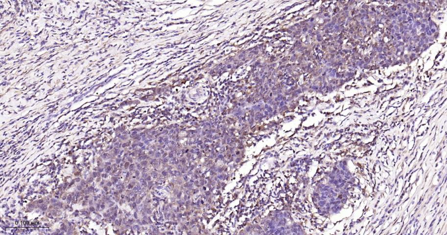 信号转导与转录激活因子1重组兔单抗