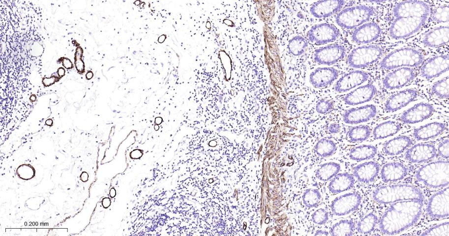 平滑肌肌球蛋白重链抗体