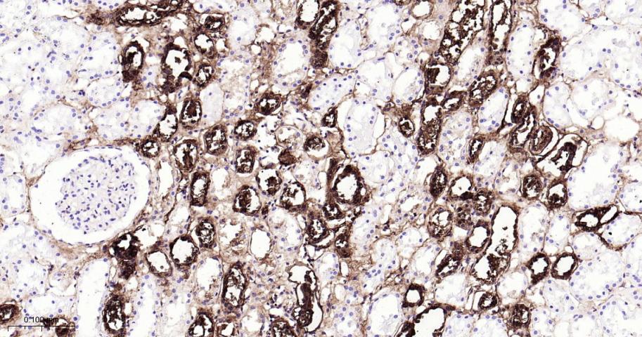 粘蛋白-1重组兔单抗