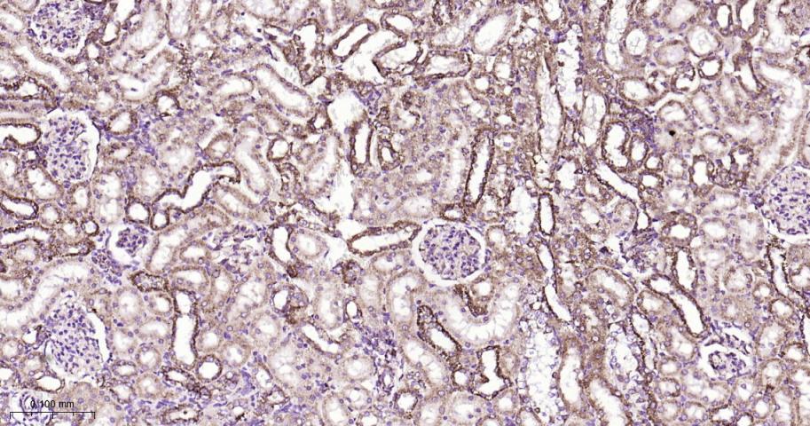 热休克蛋白10/HSPE1重组兔单抗