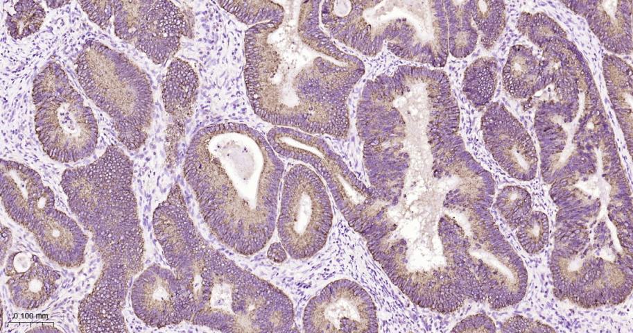 热休克蛋白10/HSPE1重组兔单抗
