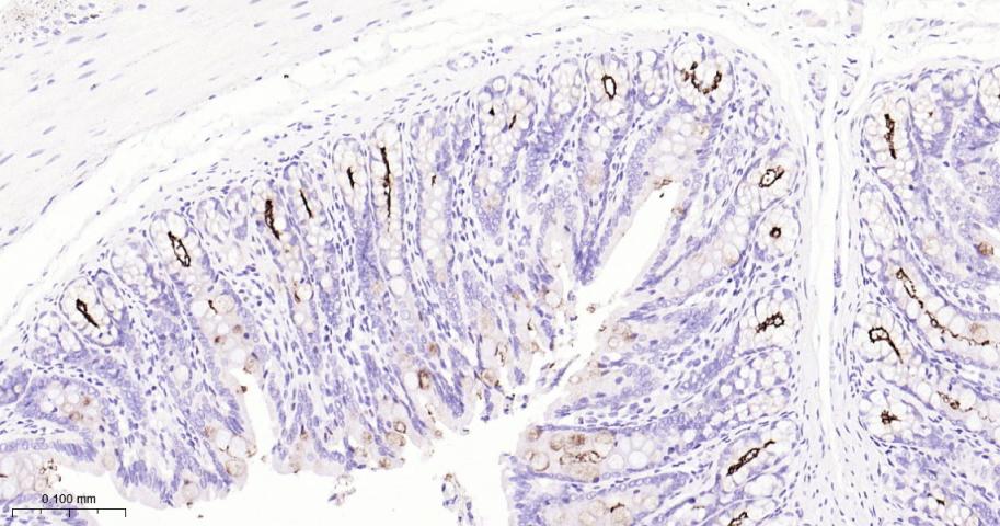粘蛋白-1重组兔单抗