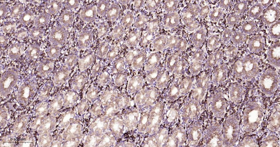 葡萄糖调节蛋白94重组兔单抗