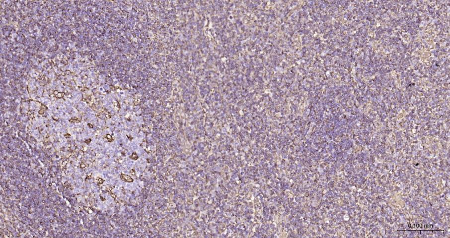 波形蛋白重组兔单抗