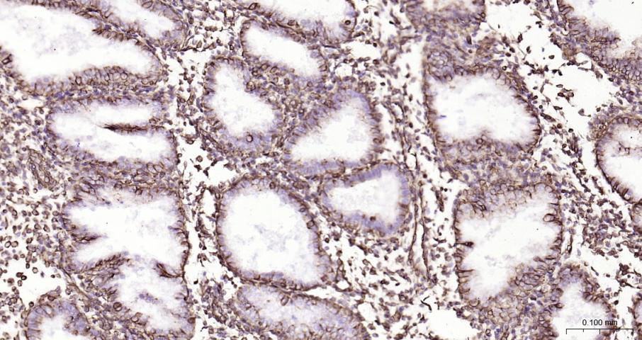 波形蛋白重组兔单抗