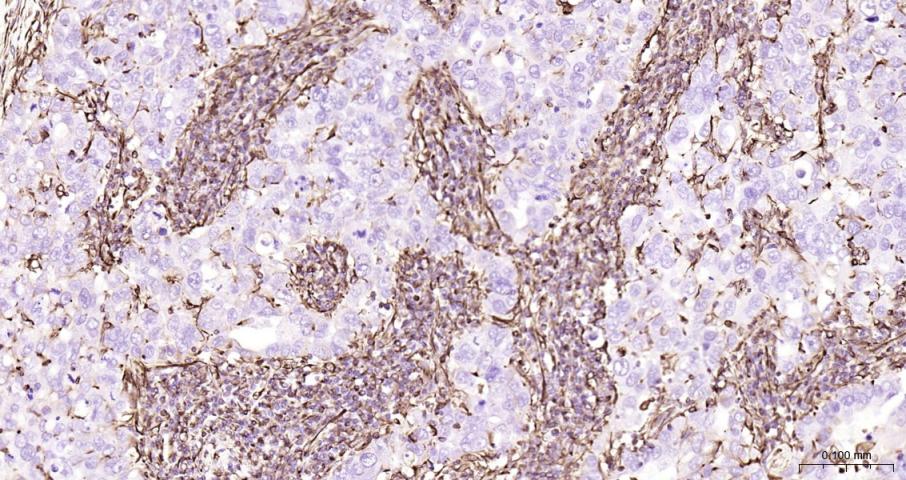 波形蛋白重组兔单抗