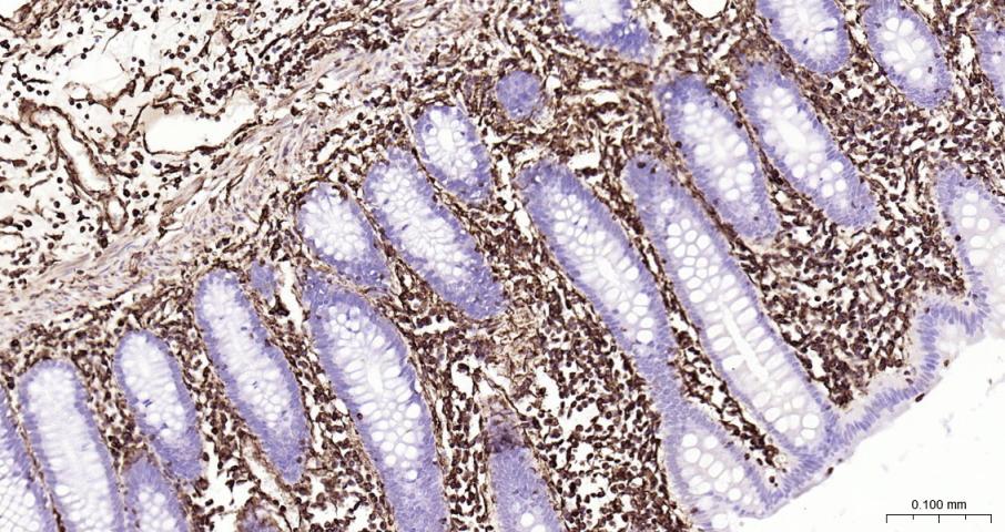 波形蛋白重组兔单抗