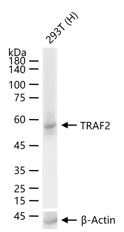 肿瘤坏死因子受体相关因子2重组兔单抗