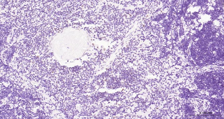 果糖-2,6-二磷酸酶3/磷酸果糖激酶2重组兔单抗-bsm-61693R