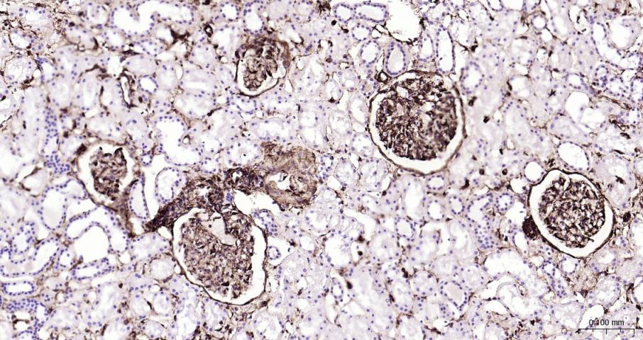 波形蛋白重组兔单抗