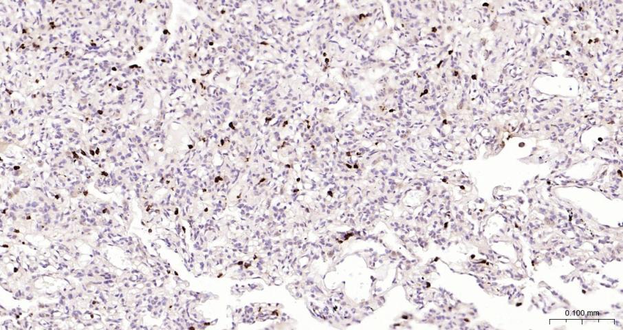 白细胞蛋白酶3重组兔单抗