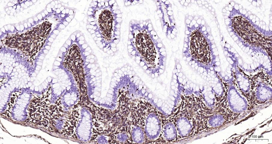 波形蛋白重组兔单抗