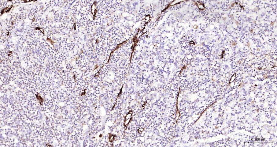 波形蛋白重组兔单抗
