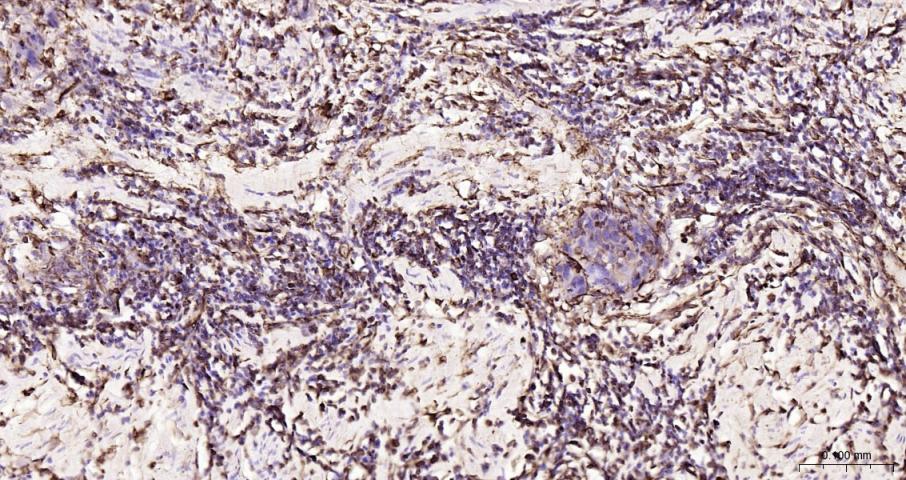 波形蛋白重组兔单抗