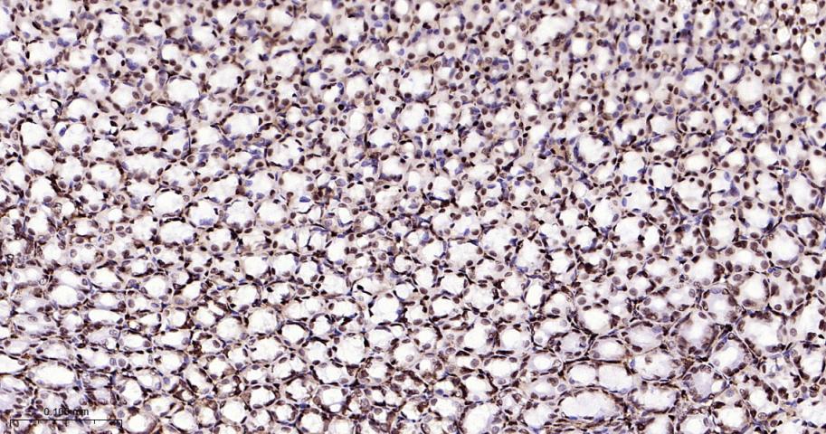 高迁移率族蛋白B1重组兔单抗