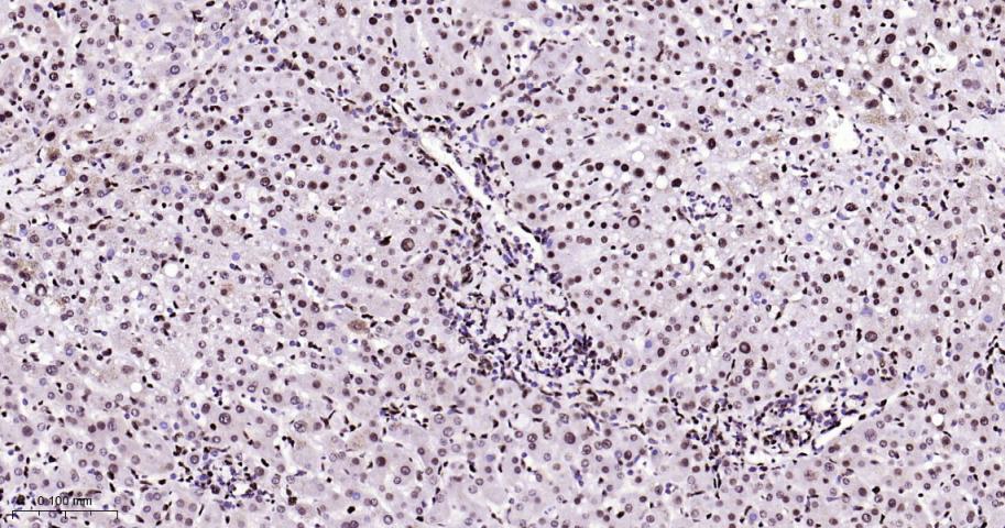 高迁移率族蛋白B1重组兔单抗