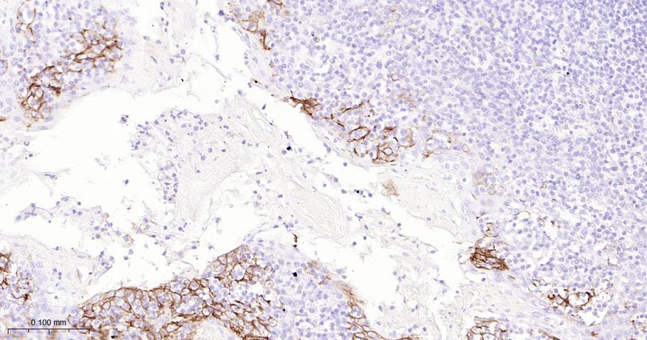 程序性死亡配体1重组兔单抗