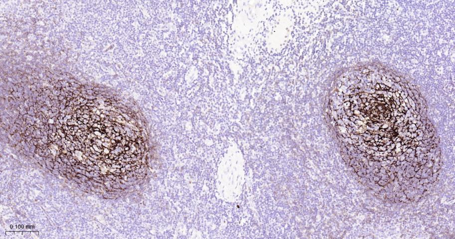 Ⅰ型补体受体重组兔单抗