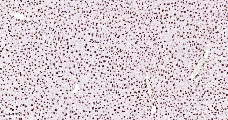 高迁移率族蛋白B1重组兔单抗