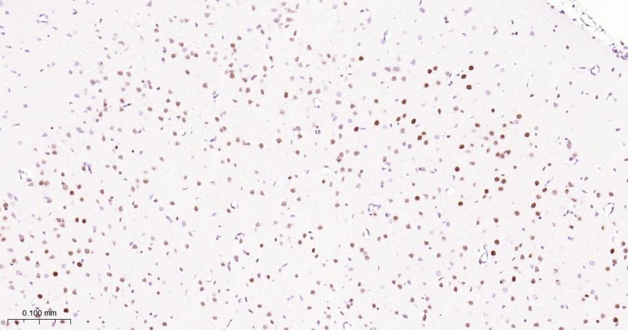 ATP依赖解旋酶SMARCA2重组兔单抗
