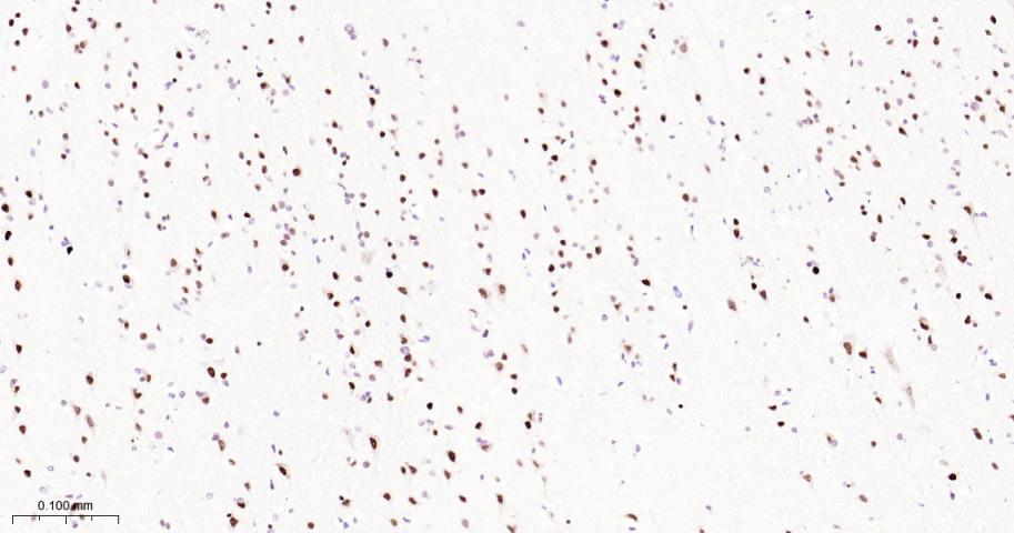 ATP依赖解旋酶SMARCA2重组兔单抗