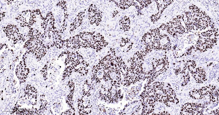 微小染色体维持缺陷蛋白2重组兔单抗