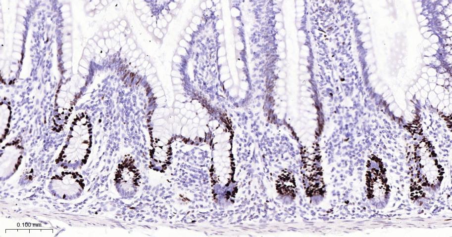 微小染色体维持缺陷蛋白2重组兔单抗
