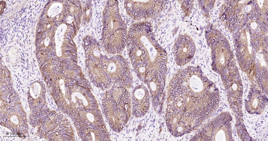 连环蛋白delta-1重组兔单抗