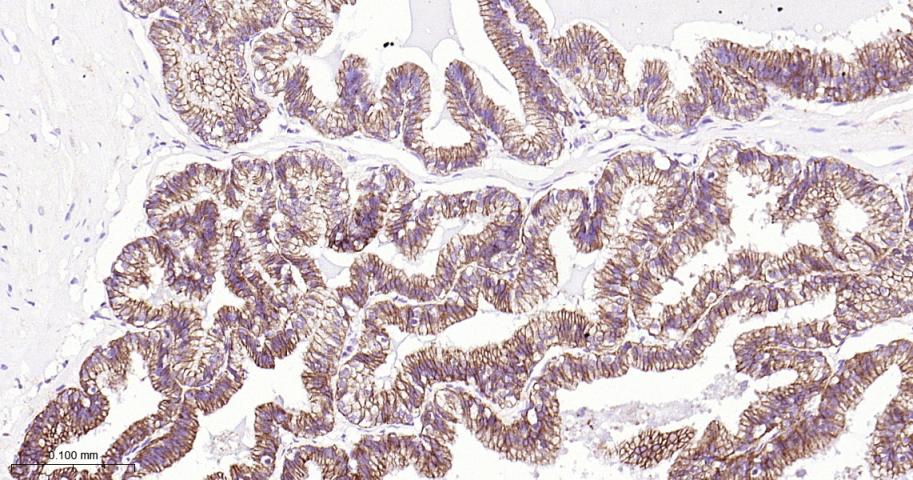 连环蛋白delta-1重组兔单抗