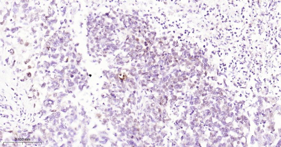 肌细胞生成素重组兔单抗