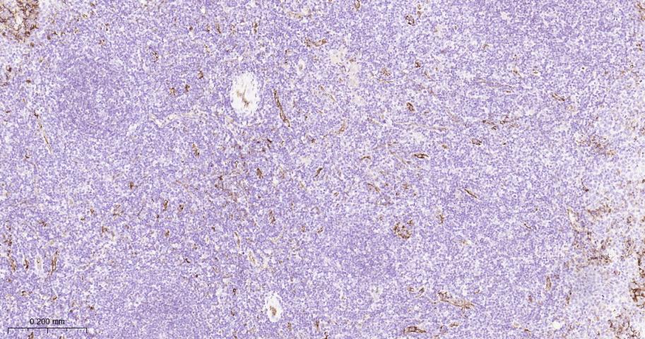 血小板内皮细胞黏附分子1重组兔单抗